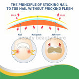 Ingrown Toenail Correction / Pain Relieve Stickers (50 pcs)