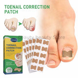 Ingrown Toenail Correction / Pain Relieve Stickers (50 pcs)