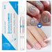 Anti-Fungal Natural Nail Treatment Pen - Indigo-Temple