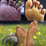 Antifungal Detox Japanese Foot Soak Treatment (6pcs)