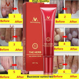 Anti-Fungal Nail & Feet Treatment Cream - Indigo-Temple