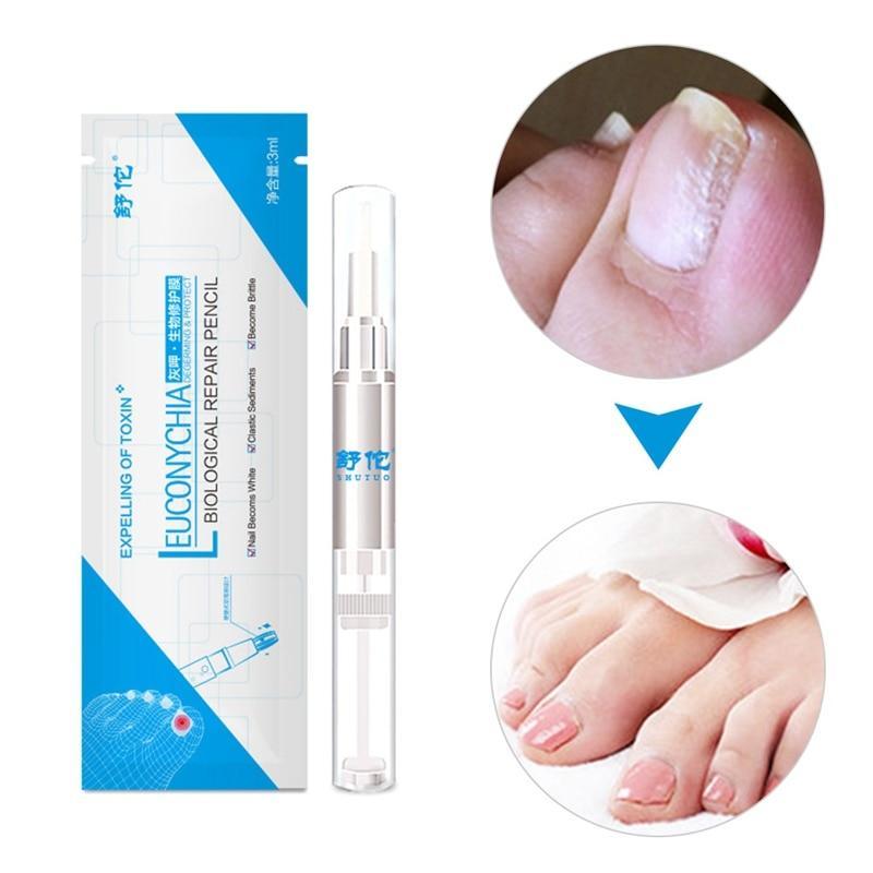 Anti-Fungal Natural Nail Treatment Pen - Indigo-Temple