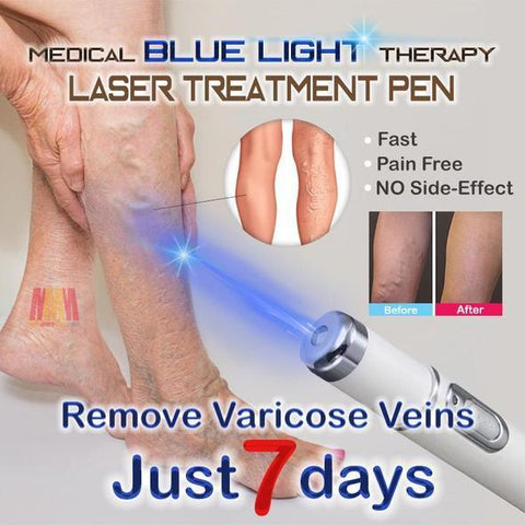 Medical Blue Light Therapy Laser Treatment Pen - Indigo-Temple